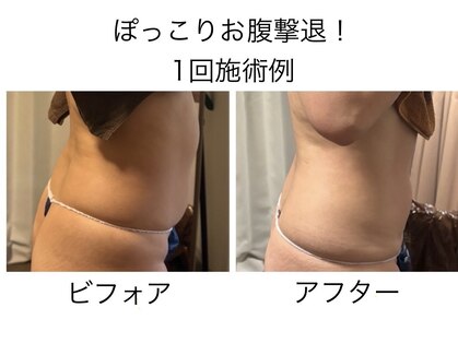 ニコ(NIKO)の写真