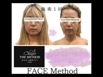 サザンベル(Southern Belle)/チノザメソッド★FACE