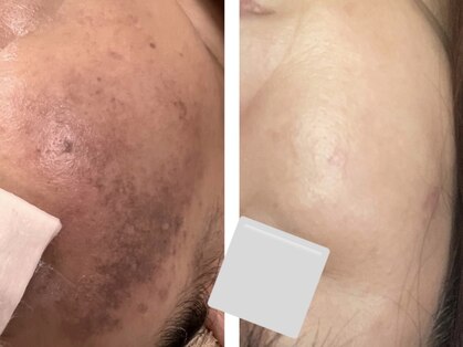 ミーシェ(Meshine)の写真