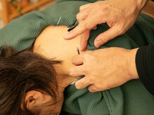 森井鍼灸整体の雰囲気（頭痛や目の疲れに驚きのスッキリ感#眼精疲労#小顔矯正#骨盤矯正）