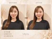 リベルタ鍼灸整骨院 なんば店(Liberta鍼灸整骨院)の雰囲気(圧倒的Before/After小顔効果を実感頂いております。)