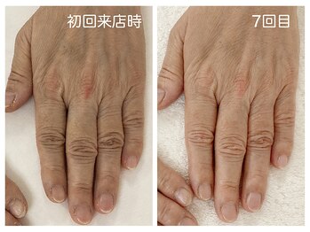 キレイテ 上野店/60代/5回目【ハンドケア稲荷町】