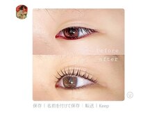 レディアリス(L'Alice)/アップフォースリフト