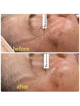 テッテ サロンドアロマ(tette salon de aroma)/before→after