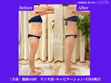 フェレザ 新潟(Felleza)/最新の痩身エステマシンです