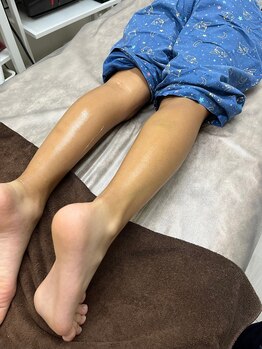 ルーメ(lume)/キッズ脱毛小学生男の子