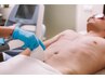 メンズ脱毛【VIO脱毛】医療提携/最新ハイレベル脱毛機を採用☆美肌パック付