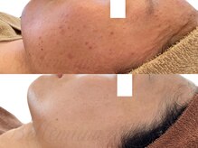 ベレミアム(Bellemium)の雰囲気（肌質改善症例多数！ご自身で肌荒れを対処できる知識も伝えます！）