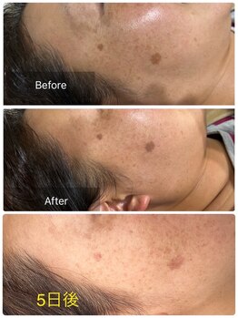 オルオル(olu olu)/