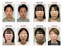 ザ リフト カドモリ 鹿児島 霧島(The Lift KADOMORI)の雰囲気（Before→Afterを撮影★）