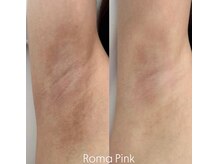 リ クリニカル ラボ(Re clinical Labo)/ローマピンク