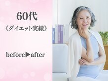 整体院カイト/60代/ビフォーアフター