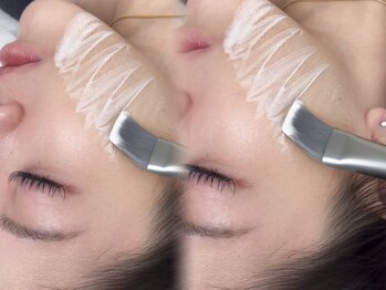 ソア(soa.)/プラピール☆彡