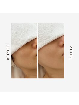 オーシャン(OCEAN)/ムートンホイップスパ