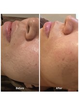 常若(tokowaka)/ダクトピール/ビフォーアフター