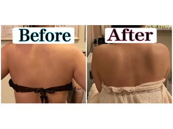 トータルビューティーサロン 凛/肩甲骨をだしたい