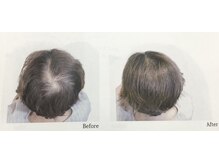 ラウナ(launa)/増毛エアエク