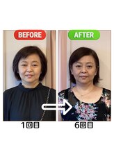 セントラル治療院はりきゅう大心/ビフォーアフター