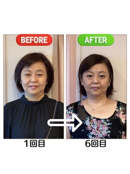 セントラル治療院はりきゅう大心/ビフォーアフター