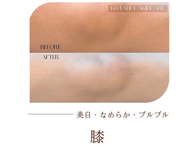 ミークチュール(me couture)｜ホットペッパービューティー
