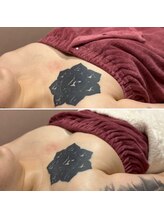 アンベリール(Embellir)/ボンボンバスト