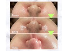 オン(WONE)の雰囲気（気になる毛穴にもしっかりアプローチ。自信のもてる素肌に。）