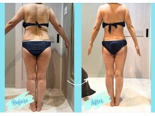 千歳の女神 岡崎店/【施術風景】Before/After