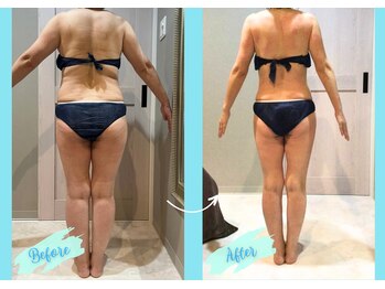 千歳の女神 岡崎店/【施術風景】Before/After