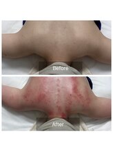 ダリア(Dahlia)/ガチガチ背中