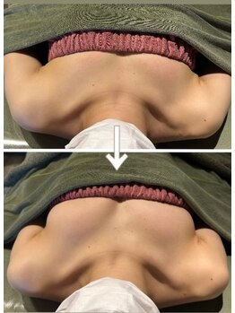 スマイルクルー(SmileClue)/ビフォーアフター症例