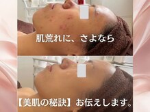 ファシル(Facile)の雰囲気（オーダーメイドハーブピーリング）