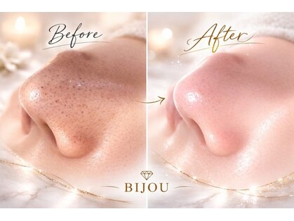 ビジュー(BIJOU)の写真