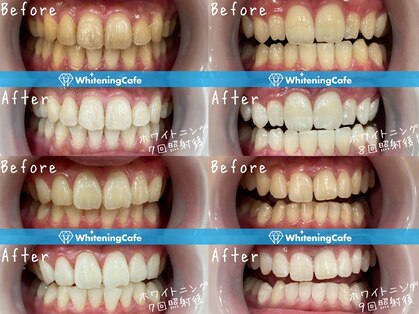 ホワイトニングカフェ 北九州小倉店(WhiteningCafe)の写真