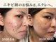 エクレ(eclat)の写真