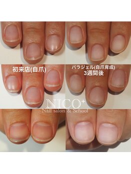 ニコプラス(NICO+)/自爪育成パラジェルクリア補強