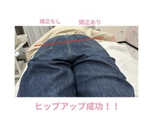 ルナ(Runa)/フェムケア矯正ビフォーアフター