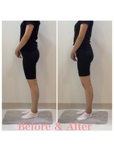 スタイルラボ高松/産後骨盤矯正の効果♪