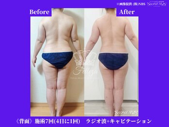 フェレザ 新潟(Felleza)/最新の美顔フェイシャルマシン♪