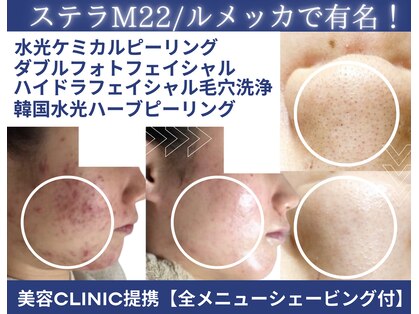 ビズビズ 神戸店(bisebise)の写真