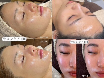 ブレデサガ(B’lady Saga)の写真