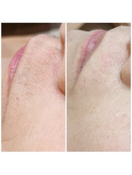 モアビューティ 庚午店(MORE BEAUTY)/