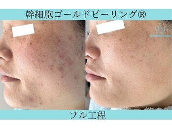 リメイククリニカルビューティー(Remake clinical beauty)/