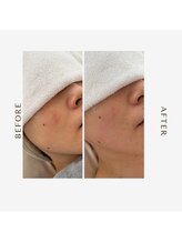 オーシャン(OCEAN)/ダブルホイップスパ