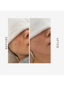 オーシャン(OCEAN)/ダブルホイップスパ