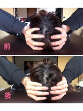 わたしの/小顔矯正