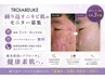 繰り返すニキビ肌本気で改善したい方　トロイアルケ症例モニター¥0 先着3名　