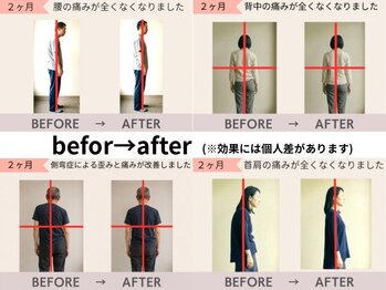 くろき鍼灸整骨院の写真/【体の歪み・姿勢矯正】10万人の実績から導き出す黄金バランス◎美しい姿勢で不調を根本改善♪