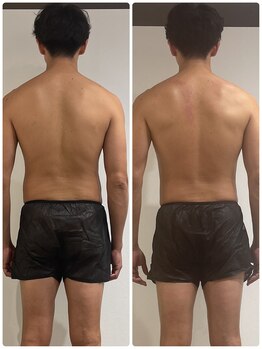 エイジングケアサロン 青山 本店/【メンズ】ビフォア・アフター