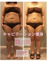 サロン ド フェイス モアナ(Salon de Faith Moana)/キャビテーション痩身【30代】