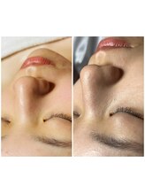 リー ビューティースパ 川崎(Ri beauty spa)/毛穴のクレンジング